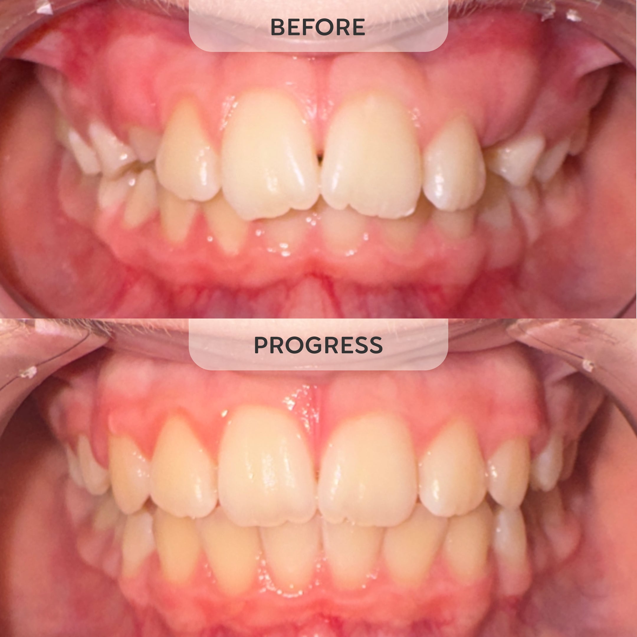 Tooth Pillow patient quality-of-life result